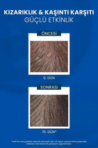 Ducray Kelual Ds Shampoo Kepeğe Karşi Şampuan 100ml
