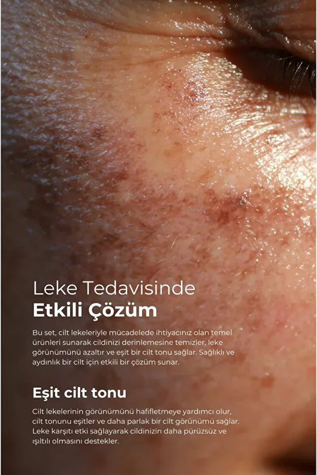 Tto Clinic Leke Kremi 75ml