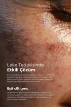 Tto Clinic Leke Serumu 50ml