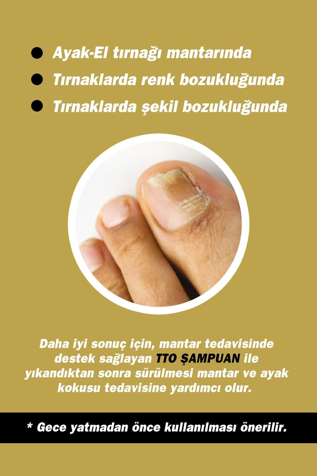 Tto Gold Nail Tirnak Solüsyonu 15ml