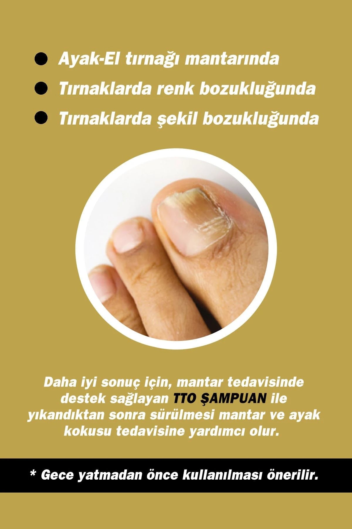 Tto Gold Nail Tirnak Solüsyonu 15ml
